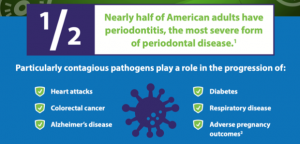 gum disease infographic